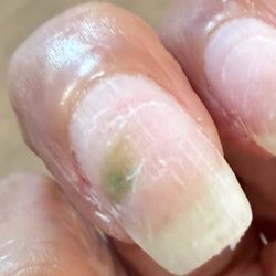 I got nail fungus from their unsanitary place
