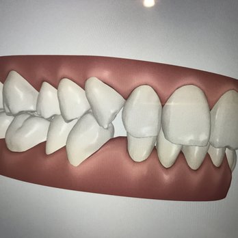 Elite Dental Irvine - Now - General Dentistry Near Me - Irvine, California