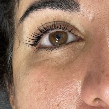 Rise And Shine Studio - After treatment - Skin Care Near Me Rise And Shine Studio - After treatment - Skin Care Near Me