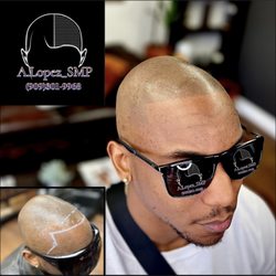Scalp micropigmentation