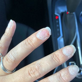 Unique Nails and Spa - How I left. I wiped my finger clean with a wipe in my car but you can see my wedding finger is jacked up. - Nail Salons Near Me - Hesperia, California Unique Nails and Spa - How I left. I wiped my finger clean with a wipe in my car but you can see my wedding finger is jacked up. - Nail Salons Near Me - Hesperia, California