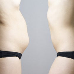 Berman Cosmetic Surgery & Skin Care Center