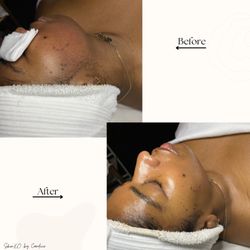SkinXO by Candice