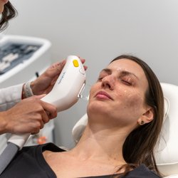 Avant Eyes Optometry & Advanced Dry Eye Center - Avant Eyes Optometry announced the expansion of their dry eye management options to include OptiLight by Lumenis, the only FDA-approve