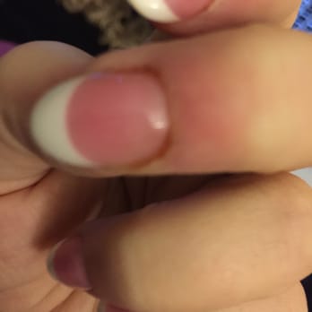 Lalu'a Nails & Spa - My bloody nail from my Lalu manicure. - Nail Salons Near Me - Silver Spring, Maryland Lalu'a Nails & Spa - My bloody nail from my Lalu manicure. - Nail Salons Near Me - Silver Spring, Maryland