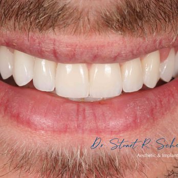 Stuart Schelkopf, DDS - Prosthodontists Near Me - Chicago, Illinois Stuart Schelkopf, DDS - Prosthodontists Near Me - Chicago, Illinois