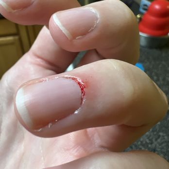 Queen Bee Nail & Spa - Bleeding 50 minutes post incident. - Nail Salons Near Me - Hamilton, New Jersey