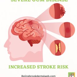 Bolingbrook Dental Care - #bolingbrookdentalcare #dentist #stroke