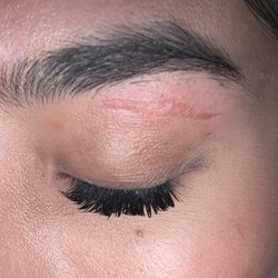 NV Nails - Eyebrow scar