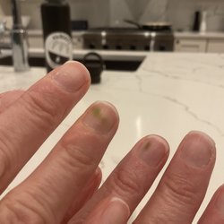 Creative Nail Spa - This is called Green Nail Syndrome from bacteria!