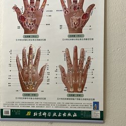 Acupuncture is so fascinating!