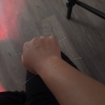 JOA Wellness - Acupuncture Near Me - Cerritos, California JOA Wellness - Acupuncture Near Me - Cerritos, California