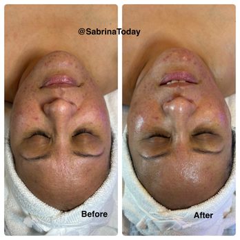 SKINBySabrina - Skin Care Near Me - Redondo Beach, California