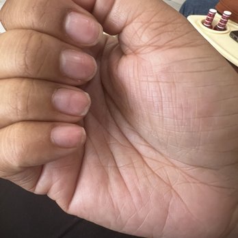 Diamond Nail Bar - Months later and my nails are half way grown out. Never thought the damage would last this long. - Nail Salons Near Me - San Jose, California Diamond Nail Bar - Months later and my nails are half way grown out. Never thought the damage would last this long. - Nail Salons Near Me - San Jose, California