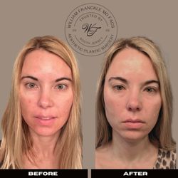 William Franckle, MD, FACS - Free Skin Consultations.