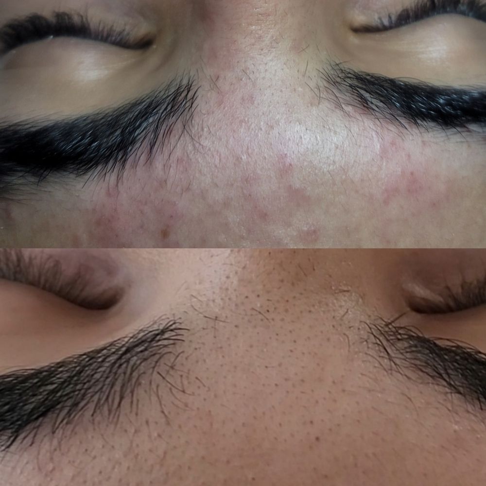 GREEN APPLE SKIN CARE Updated August 2024 Request an Appointment