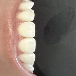 South Peek Dental Care - After