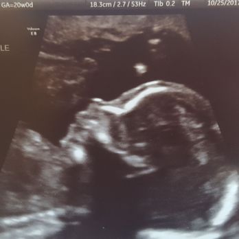 TPA Wellness Center - Just found out yesterday Im having a Baby Boy!!! * THANK YOU GOD AND DR WANG - Fertility Near Me - Temecula, California TPA Wellness Center - Just found out yesterday Im having a Baby Boy!!! * THANK YOU GOD AND DR WANG - Fertility Near Me - Temecula, California