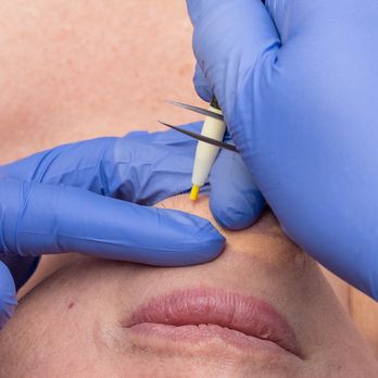 Olysis Med Spa - Laser Hair Removal Near Me - Dallas, Texas Olysis Med Spa - Laser Hair Removal Near Me - Dallas, Texas