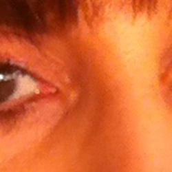 dpEsthetics - Eyelash growth enhancer available