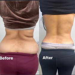 Skin Focus