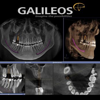 MB Dentistry - Cosmetic Dentists Near Me - Anaheim, California MB Dentistry - Cosmetic Dentists Near Me - Anaheim, California