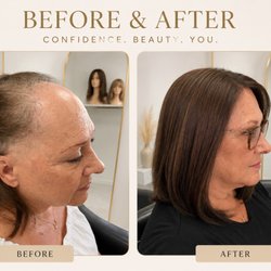 Vivir Se’ar - Alopecia Client, custom hair topper made for her.