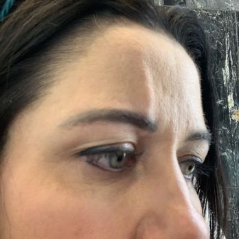 Invigorate Advanced Aesthetics - Medical Spas Near Me - Englewood, Colorado Invigorate Advanced Aesthetics - Medical Spas Near Me - Englewood, Colorado