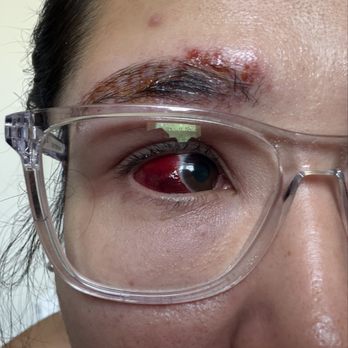 Face Forward - Aftermath of eyelash lift/tint and eyebrow tint/wax - Skin Care Near Me - Anchorage, Alaska
