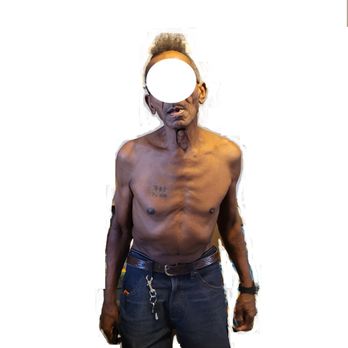 Lifewell Behavioral Wellness - emaciated and getting skinner due to poor nutrition from Lifewell Facility. - Counseling & Mental Health Near Me - Phoenix, Arizona Lifewell Behavioral Wellness - emaciated and getting skinner due to poor nutrition from Lifewell Facility. - Counseling & Mental Health Near Me - Phoenix, Arizona