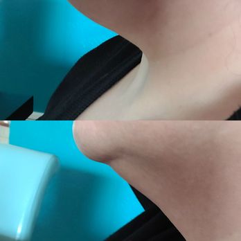 Millard Plastic Surgery - Cosmetic Surgeons Near Me - Englewood, Colorado Millard Plastic Surgery - Cosmetic Surgeons Near Me - Englewood, Colorado