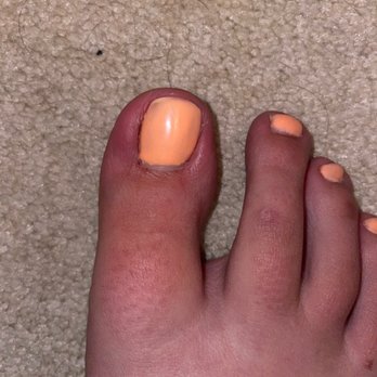 Lacquer Nail Spa - Not infected but still pretty red - Nail Salons Near Me - Wichita, Kansas