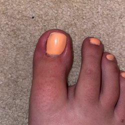 Lacquer Nail Spa - Not infected but still pretty red
