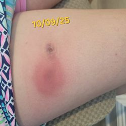 Georgia Skin & Cancer Cllinic