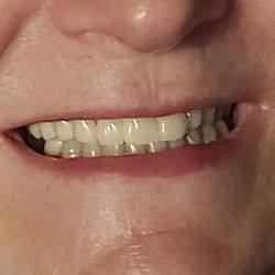 Decatur Family & Cosmetic Dentistry - My teeth