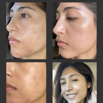 LV Skin & Laser - Laser Hair Removal Near Me - Las Vegas, Nevada LV Skin & Laser - Laser Hair Removal Near Me - Las Vegas, Nevada