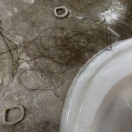 Daily hair loss Daily hair loss