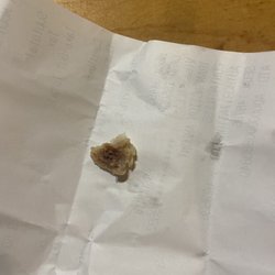 This was in my McChicken!!!!!!!!