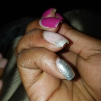 Elegance Nail II - Two days after removing the acrylic the color changed from yellow & green, to a dark brown. Still sore & tender. - Nail Salons Near Me - Middlesex, New Jersey Elegance Nail II - Two days after removing the acrylic the color changed from yellow & green, to a dark brown. Still sore & tender. - Nail Salons Near Me - Middlesex, New Jersey