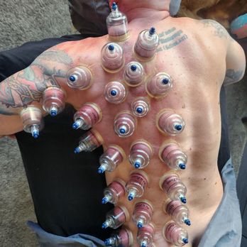 Elite Therapeutics - Massage Therapy Near Me - San Diego, California Elite Therapeutics - Massage Therapy Near Me - San Diego, California