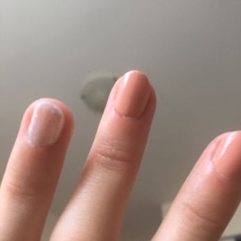 Pinky Beauty Bar - Was bleeding a lot and there is a chunk of my nail bed missing on middle finger - Nail Salons Near Me - Vancouver, British Columbia