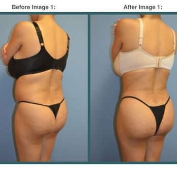Associates in Plastic Surgery - Contact Us Today for a Consultation: https://www.associatesinplasticsurgery.com/contact-us - Medical Spas Near Me - Edison, New Jersey
