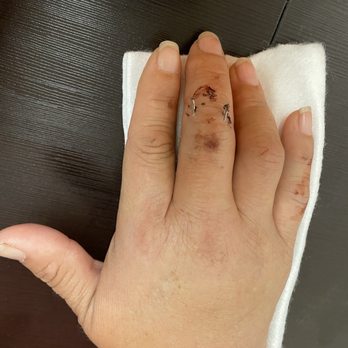 Manale Occupational & Physical Therapy - Injuries sustained in a fall. - Occupational Therapy Near Me - Bellflower, California Manale Occupational & Physical Therapy - Injuries sustained in a fall. - Occupational Therapy Near Me - Bellflower, California