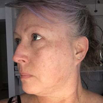Skin Laundry - Folsom Palladio - Skin Care Near Me - Folsom, California Skin Laundry - Folsom Palladio - Skin Care Near Me - Folsom, California
