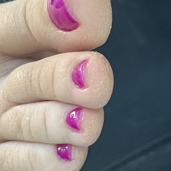 iNails and Spa - Dry flaky toes and hell dripping under my nails. - Waxing Near Me - Henderson, Nevada iNails and Spa - Dry flaky toes and hell dripping under my nails. - Waxing Near Me - Henderson, Nevada