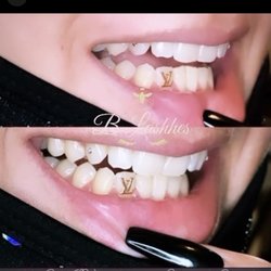 B Lashhes