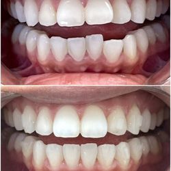 Serene Smiles Dental