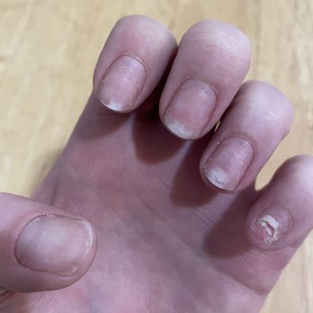 Organic Nails & Spa - My pinky nail is almost completely ripped off! - Nail Salons Near Me - Bakersfield, California Organic Nails & Spa - My pinky nail is almost completely ripped off! - Nail Salons Near Me - Bakersfield, California