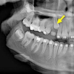 Treasure Coast Dental Specialists