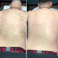 Men's full back wax